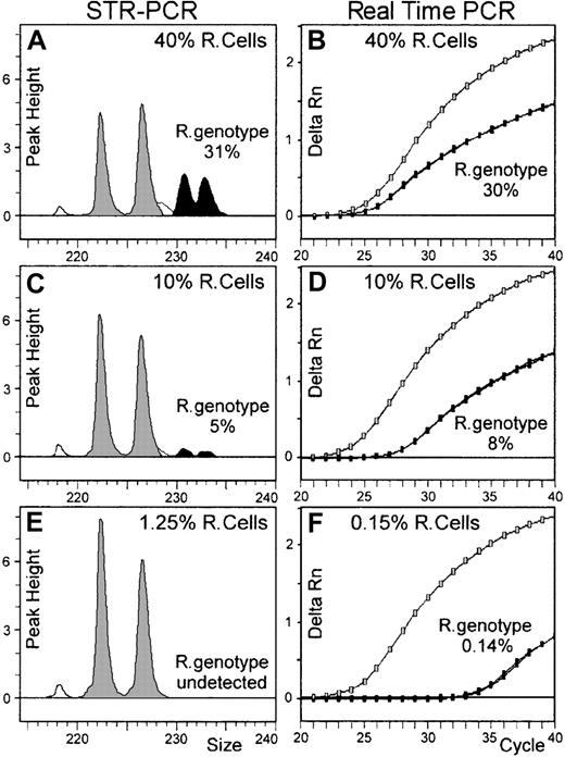 Fig. 3. Comparison of STR-PCR and real-time PCR chimerism assays. / DNA extracted from different cell mixtures was evaluated for recipient genotype fraction by both fluorescent-based STR-PCR and real-time PCR chimerism assays. Panels A, C, and E show the results obtained on 3 DNAs (until the 1.25% recipient cell fraction) with STR-PCR using the D21S11 marker. Recipient-specific alleles (black peaks) and donor-specific alleles (gray peaks) define peak areas proportional to each individual-genotype fraction. In this case, longer recipient genotype–specific alleles seem less efficiently amplified than shorter donor alleles. Panels B, D, and F show the results obtained with real-time PCR on 3 DNAs (until the 0.15% recipient cell fraction). As the recipient cell fraction decreased in amplified DNA, amplification curves of allelic marker S 09a, specific for recipient genotype (black dotted lines), shift to the right; by contrast, amplification curves of the allelic marker S 09b, specific for the donor genotype, shift slightly to the left. In fact, these specific amplifications were independently performed in real-time PCR assay, and the sensitivity level for minor genotype detection is greatly improved, compared with STR-PCR assay results (compare panels E and F).