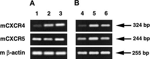 Fig. 10. Regulation of CXCR4 and CXCR5 gene expression by IL-10. / (A) The level of CXCR4 and CXCR5 expression by peritoneal B lymphocytes was evaluated by RT-PCR in freshly isolated cells (lane 1) or in cells cultured for 4 hours with a control antibody (lane 2) or an anti–IL-10R Ab (lane 3). Results are from one representative out of 2 experiments. Densitometry analysis of amplified products showed that the CXCR4/β-actin ratio (mean ± SEM) was 0.43 ± 0.09, 1.02 ± 0.07, and 1.01 ± 0.02 for lanes 1 to 3, respectively. Similar analysis for CXCR5 gene expression showed a CXCR5/β-actin ratio (mean ± SEM) of 0.78 ± 0.06, 0.91 ± 0.07, and 1.01 ± 0.03 for lanes 1 to 3, respectively. (B) The level of CXCR4 and CXCR5 expression by peritoneal B lymphocytes was evaluated by RT-PCR in freshly isolated cells (lane 4) or in cells cultured for 2 hours without (lane 5) or with IL-10 (lane 6). Results are from a single experiment. Densitometry analysis of amplified products showed that the CXCR4/β-actin ratio was 0.35, 0.88, and 0.85 for lanes 4 to 6, respectively. Similar analysis for CXCR5 gene expression showed a CXCR5/β-actin ratio of 0.44, 0.63, and 0.45 for lanes 4 to 6, respectively.