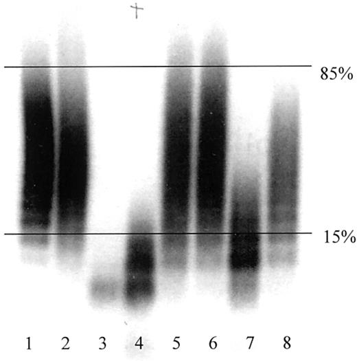 Fig. 1. Representative autoradiograph of VWCP activity assay. / Undigested VWF and VWCP-proteolyzed VWF were detected by antibody labeling and radiography as described in “Patients, materials, and methods.” Horizontal lines indicate the 15th and 85th percentiles of the undigested VWF multimer range. Lanes 1 and 2, undigested VWF; lane 3, normal VWCP activity; lanes 4, 7, and 8, intermediate VWCP activity; lanes 5 and 6, deficient VWCP activity.
