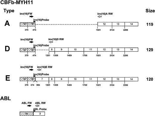 Fig. 1. Position of primers and probe for CBFβ-MYH11 transcript types A, D, and E, and for the. / ABL gene. CBFβ-MYH11 transcript types A, D, and E: the probe (▬) inv(16) Probe (5′ TTC AAA TTC GCG TGT CCT TCT CCG A) and the sense primer (➡) inv(16) FW (5′ TTA GCA CAA CAG GCC TTT GAA) are positioned in exon 5 of the CBFβ gene. The reverse primers ()inv(16)A RW (5′ CAG GGC CCG CTT GGA), inv(16)D RW(5′ CCT CGG CCT CGT TAA GCA T), and inv(16)E RW (5′ GCG TCT GCT TAT TCT TGT CTA GGT T) are positioned in exons 12, 8, and 7 of theMYH11 gene for transcript types A, D, and E, respectively.ABL gene: the probe (▬) ABL Probe (5′ CCA GTA GCA TCT GAC TTT GAG CCT CAG GG) and the reverse primer () ABL RW (5′ TGG GTC CAG CGA GAA GGT T) are positioned in exon 2 of the ABL gene. The sense primer (➡)ABL FW (5′ TCC TCC AGC TGT TAT CTG GAA GA) is positioned in exon 1b of the ABL gene.