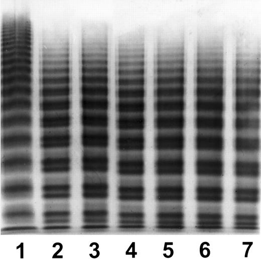 Fig. 1. SDS agarose electrophoresis VWF multimer analysis of paired lots of A-SD and A-SD/HT. / Gels were prepared in 1.7% agarose.
