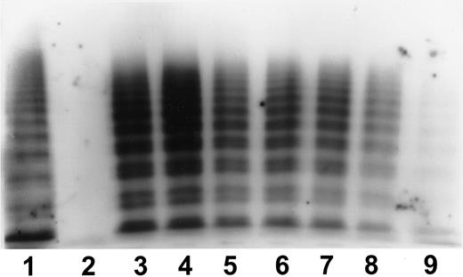 Fig. 3. SDS agarose electrophoresis VWF plasma multimer analysis before and after infusion of A-SD/HT (60 IU/kg VWF:RCof) in a representative patient with type 3 VWD. / Gels were prepared in 1.2% agarose. Lane 1, normal pooled plasma; lane 2, before infusion; lane 3, 15 minutes after infusion; lanes 4 through 9, 1, 3, 6, 12, 24, and 48 hours after infusion. Increased size in circulating VWF multimers was observed for more than 24 hours after infusion.