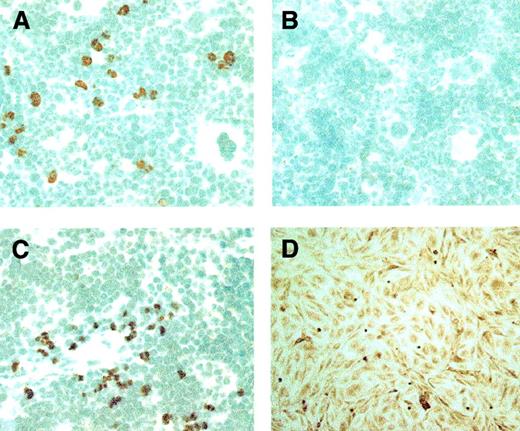 Fig. 3. Transfected BOECs detected in mouse marrow and spleen. / tBOECs are identified in murine tissues by peroxidase staining using an antibody to human β2-microglobulin. (A, C) Human tBOECs in murine marrow and spleen, respectively, at 156 days after administration. (B) Negative control—marrow from a NOD-SCID mouse that did not receive BOEC. (D) Positive control—monolayer culture of BOEC. Original magnification, × 600.