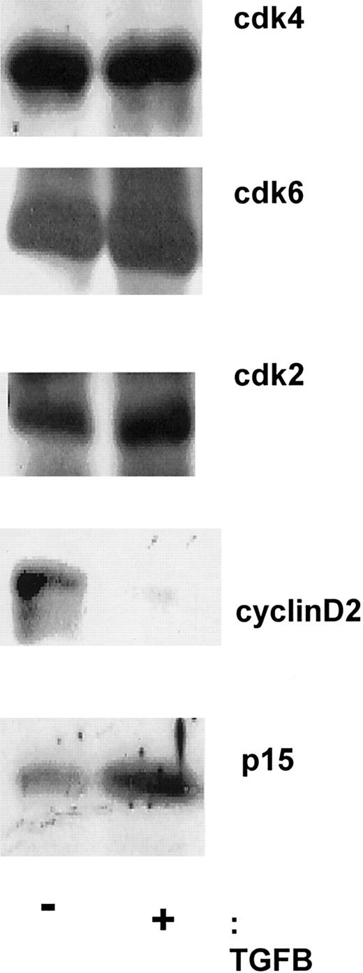 Fig. 3. Addition of soluble TGF-β1 alters the levels of cyclin D2, not cyclin D3, cdk2, cdk4, or cdk6. / After incubating with and without soluble TGF-β1 for 18 hours, CD34+ progenitors were lysed in 1% NP-40, loaded onto a 10% or 15% SDS-PAGE gel, and transferred to Immunobilon PSQ membrane. Immunoblotting with antibodies to cdk4 (SC-749), cdk6 (SC-7961), cyclin D2 (SC-754), cyclin D3 (D-7), and p15 (SC-613) was then performed.