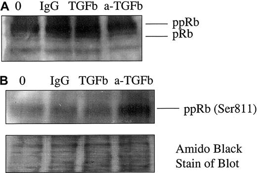 Fig. 5. Soluble TGF-β1 specifically decreased the level of pRb phosphorylation. / CD34+ progenitors were incubated in the presence or absence of soluble TGF-β1 or neutralizing antibody to TGF-β1 (a-TGFB) for 48 hours. Total lysates were run on 7.5% SDS-PAGE gel and transferred onto Immunobilon membrane. (A) Immunoblotting with an antibody that recognizes underphosphorylated, hypophosphorylated, and hyperphosphorylated forms of pRb. (B) Immunoblotting with an antibody specific to Ser811 pRb. Membranes were also stained in amido black staining to ensure equal protein loading in all lanes.