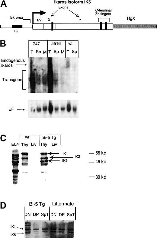 Fig. 1. Generation of transgenic mice expressing the Ikaros isoform IK5. / (A) Representation of the construct used to generate IK5 (bi-5) transgenic mice. The construct contains the lck proximal promoter and the Eμ immunoglobulin heavy-chain enhancer to direct expression of IK5. The IK5 cDNA lacks exons 4 to 6, which eliminates 3 of 4 possible DNA-binding zinc fingers, yet retains all of the C-terminal Zn++ fingers. The HgX minigene has been shown to enhance the expression of transgenes and was part of the original p1026 promoter construct.9 (B) Northern blot of the 2 different bi-5 lines, 747 and 5516, using a probe containing exon 7 of Ikaros. Both endogenous Ikaros and transgene mRNA are marked in the figure. Cells used include thymocytes (T), splenocytes (Sp), and total bone marrow (M). The blot is slightly overexposed to better visualize marrow and spleen expression of the transgene. The HgX minigene, although not capable of being translated, contains both introns and exons; therefore, the transgene mRNA is expressed as multiple, overlapping bands. The lower panel shows the blot after stripping and reprobing for elongation factor-1α (EF) to account for loading differences. (C) Western blot using antisera against the C-terminal portion of Ikaros, which recognizes all Ikaros isoforms. Samples include protein isolated from the thymus (Thy) and liver (Liv) of bi-5 transgenic line 747 and a littermate control (wt). (D) Cell equivalent Western blot using 100 000 sorted cells per lane. Samples include DN and DP thymocytes and splenic T cells (Sp T) from a representative bi-5 mouse (Bi-5 Tg) and littermate control (littermate).