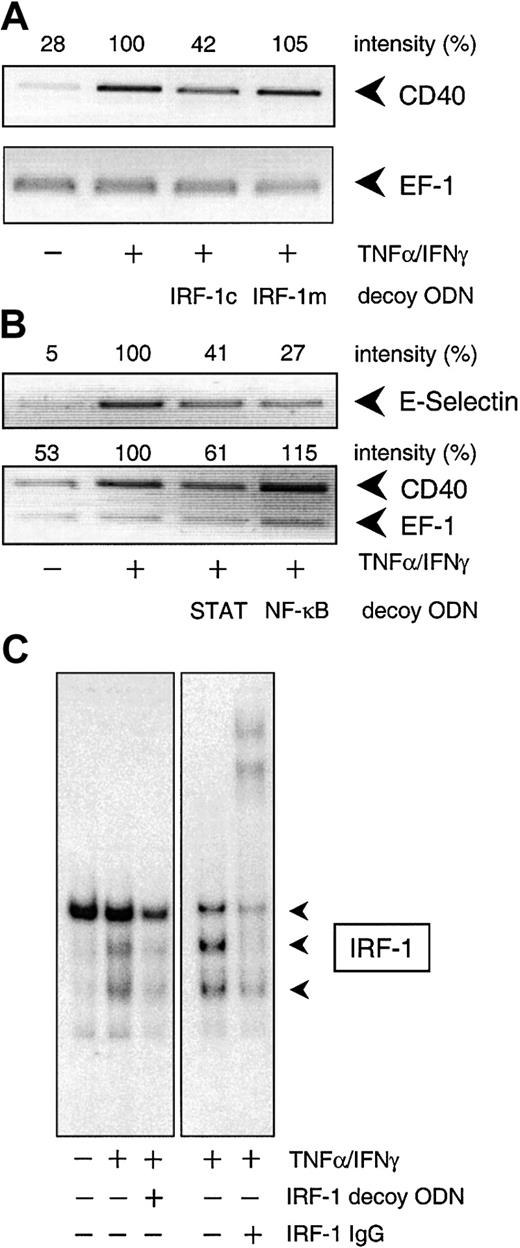 Fig. 4. Specificity of the decoy ODN technique in cultured HUVECs and THP-1 cells. / (A) Example of the specificity of the consensus decoy ODN for IRF-1. Cytokine-stimulated (100 U/mL TNF-α, 1000 U/mL IFN-γ) CD40 expression is significantly reduced in HUVECs pretreated with the consensus (IRF-1c) but not with the mutant (IRF-1m) decoy ODN. (B) Effects of the STAT-1 or NF-κB consensus decoy ODN on CD40 and E-selectin expression in HUVECs exposed to TNF-α (100 U/mL) plus IFN-γ (1000 U/mL) for 9 hours. Typical RT-PCR analyses are shown; comparable results were obtained in 2 further experiments each with different batches of cells. (C) Effect of a 4-hour preincubation with the IRF-1 consensus decoy ODN (10 μM) on nuclear translocation of IRF-1 in THP-1 cells exposed to TNF-α (100 U/mL) plus IFN-γ (1000 U/mL) for 3 hours. Typical EMSA is shown, with the appropriate supershift analysis (IRF-1 IgG) performed with a single batch of THP-1 cells. Identical results were obtained with another batch of cells.