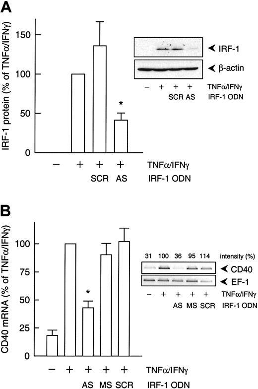 Fig. 5. IRF-1 antisense ODN effect on cytokine-induced CD40 expression. / (A) Statistical summary of IRF-1 protein expression after 3 hours (calculated as percentage of cytokine-stimulated IRF-1 expression) in TNF-α (100 U/mL) plus IFN-γ (1000 U/mL)–stimulated HUVECs pretreated with an IRF-1 antisense (AS) or scrambled control (SCR) ODN, as described in “Materials and methods” (n = 3; *P < .05 versus TNF-α/IFN-γ). (B) Statistical summary of the effects of the IRF-1 antisense (AS) ODN or the corresponding missense (MS) or scrambled (SCR) control ODN on TNF-α (100 U/mL) plus IFN-γ (1000 U/mL)–stimulated CD40 mRNA expression after 9 hours (calculated as percentage of the stimulated control) in the cultured HUVECs (n = 3; *P < .05 versus TNF-α/IFN-γ). The insets show a representative Western blot and RT-PCR analysis, respectively.