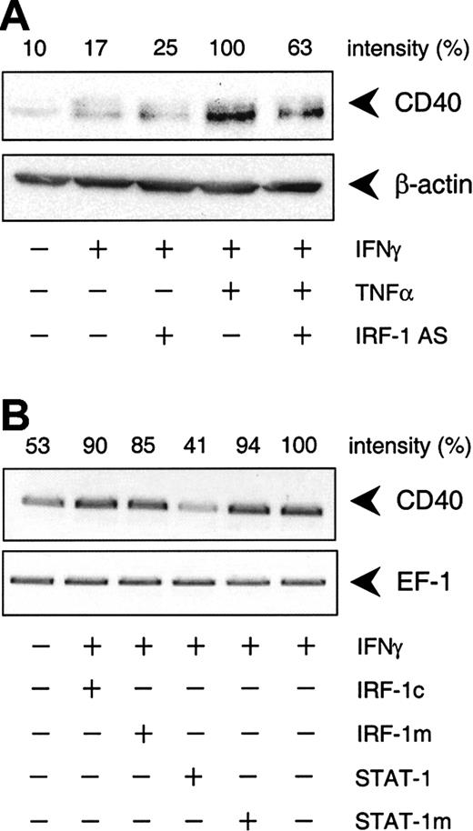 Fig. 6. IFN-γ–stimulated CD40 protein expression is predominantly STAT-1 dependent. / (A) Effect of the IRF-1 antisense (AS) ODN on IFN-γ (1000 U/mL) or TNF-α (100 U/mL) plus IFN-γ (1000 U/mL)–stimulated CD40 protein expression in the cultured HUVECs after 14 hours. Representative Western blot analysis is shown. (B) Effects of the STAT-1 or IRF-1 consensus decoy ODN (STAT-1, IRF-1c) or mutant control ODN (STAT-1m, IRF-1m) on CD40 expression in cells exposed to IFN-γ (1000 U/mL) alone for 9 hours. Representative RT-PCR analysis is shown; comparable results were obtained with 2 further batches of cells.