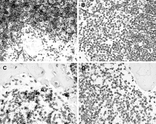 Fig. 1. Validation of in situ methods. / (A) In situ hybridization with 35S-labeled antisense probes results in an accumulation of black silver grains, indicating RAG expression in cortical but not in medullary thymocytes of a human thymus. (B) Hybridization with sense control probes shows no specific labeling. (C) In situ hybridization reveals scattered RAG-positive cells in bone marrow, whereas (D) hybridization with sense probes shows no specific labeling.