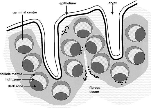 Fig. 5. Distribution of RAG+/TdT+ cells in human tonsil. / RAG+/TdT+ cells (black dots) are shown in relation to tonsillar architecture.