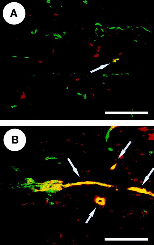 Fig. 1. Up-regulation of TSP-2 expression in cutaneous inflammation. / Differential immunofluorescent staining for CD31 (green) and TSP-2 (red) in normal wild-type mouse skin (A) revealed several TSP-2–expressing nonendothelial cells within the dermis but only a few TSP-2–positive blood vessels (yellow, arrow). (B) Twenty-four hours after oxazolone challenge the TSP-2 expression is up-regulated in fibroblasts, and an increased number of TSP-2–positive blood vessels (yellow, arrows) were observed. Scale bar = 100 μm.