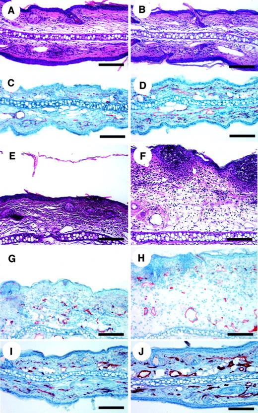 Fig. 3. Increased angiogenesis and inflammation in cutaneous DTH reactions elicited in TSP-2–deficient mice. / No apparent morphologic differences were found between the untreated ear skin of wild-type (A) and TSP-2–deficient mice (B). However, CD31 stains revealed increased skin vascularization in TSP-2–deficient mice (D), as compared with wild-type mice (C). Highly increased edema formation and inflammatory infiltration in the skin of TSP-2–deficient mice (F) at 24 hours after antigen challenge, as compared with wild-type mice (E). CD31 stains demonstrated enhanced angiogenesis 24 hours after challenge in TSP-2–deficient mice (H), as compared with wild-type mice (G). Twenty-eight days after challenge, the ear thickness of wild-type mice (I) and TSP-2–deficient mice (J) returned to normal levels, whereas blood vessels in the skin of TSP-2–deficient mice remained enlarged (J). Hematoxylin/eosin stains were used to produce panels A, B, E, and F, and CD31 stains for panels C, D, and G-J. Scale bars = 125 μm.