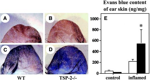Fig. 5. Enhanced vascular leakage in the inflamed skin of TSP-2–deficient mice. / No major differences were found in the extent of plasma extravasation in untreated skin between wild-type mice (A) and TSP-2–deficient mice (B), as evaluated after intravenous injection of Evans blue. In contrast, topical application of mustard oil to the ear skin resulted in a more pronounced vascular leakage of Evans blue in TSP-2–deficient mice (D), as compared with wild-type mice (C). To quantify the plasma extravasation, Evans blue was extracted from the skin. No major differences were found in the amount of Evans blue extravasation in untreated skin of TSP-2–deficient (▪) and wild-type (■) mice (E), whereas leakage was increased more than 2.4-fold in the inflamed skin of TSP-2–deficient mice, as compared with wild-type mice. Data are expressed as mean ± SD. *P < .05.