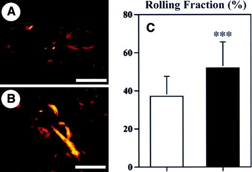 Fig. 6. Enhanced rolling of leukocytes in cutaneous blood vessels of TSP-2–deficient mice. / Immunofluorescent stains for CD31 (red) and P-selectin (green) demonstrated increased P-selectin expression in cutaneous blood vessels (yellow) of TSP-2–deficient mice (B), as compared with wild-type mice (A). Scale bars = 100 μm. (C) Intravital microscopy revealed that the rolling fraction of leukocytes in cutaneous blood vessels of TSP-2–deficient mice (▪) was increased by 39.6% over wild-type mice (■). Data are expressed as mean ± SD. ***P < .001.