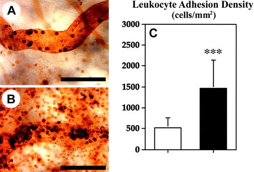 Fig. 7. Enhanced leukocyte adhesion in blood vessels of TSP-2–deficient mice during skin inflammation. / Twenty-four hours after oxazolone challenge, mice were perfused with the lectin L esculentum to visualize leukocytes adherent to the luminal surface of blood vessels. Although only sparse leukocytes were found to be adherent to blood vessels of wild-type mice (A), an increased density of adherent leukocytes was detected in TSP-2–deficient mice (B). Scale bars = 100 μm. (C) Quantitative analyses of lectin-perfused skin revealed a 2.8-fold increase in leukocyte adhesion density in TSP-2–deficient mice (▪), as compared with wild-type mice (■). Data are expressed as mean ± SD. ***P < .001.