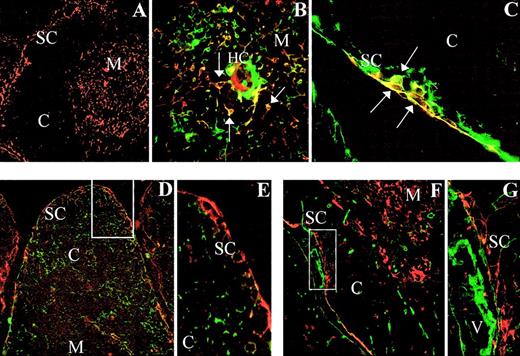 Fig. 1. Expression of SDF-1α in the human thymus. / Frozen sections of human thymus were double stained with anti–SDF-1α alone (red fluorescence; A) or in combination with anti–TE-4 (green fluorescence; B,C), anti–TE-3 (green fluorescence; D,E), or anti–type I collagen (green fluorescence; F,G). SDF-1α expression is detected in TE-4+ epithelial cells (yellow cells, arrows) appearing in the thymic subcapsular (C) and medullary areas (B). Note the absence of SDF-1α expression in TE-3+ cortical epithelial cells (D,E), and type I collagen-positive fibroblasts (F,G). SC indicates subcapsullary area; C, cortex; M, medulla; HC, Hassal corpuscle; V, blood vessel. Original magnifications: panel A, × 50; panels B, E, and G, × 250; panel C, × 150; and panels D and F, × 75.