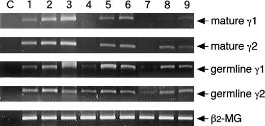 Fig. 3. Induction of mature γ1 and γ2 transcripts from naive B cells. / Highly purified adult CD20+CD27+, CD20+CD27−, or CB B cells at the cell numbers of 0.5 × 106 cells were cultured with medium alone (lanes 1, 4, 7), 0.01% SAC, 50 U/mL IL-2, 50 ng/mL IL-10, and 1 μg/mL anti-CD40 cross-linked with CD32T for 1 day (lanes 2, 5, 8) or 4 days (lanes 3, 6, 9). After extraction of total RNA, RT-PCR was performed as described in “Materials and methods.” PCR primers of germline Cγ transcripts were prepared in the initiation region (Iγ1 or Iγ2) and the hinge of constant region (Cγ1 or Cγ2). PCR primers of mature Cγ transcripts were prepared in the regions of JH of V region and of the hinge of constant region. Each template contained the same of cDNA from RNA extracted from highly purified B cells. The C lanes represent control of contamination-free reaction, in which all PCR reagents are present, but there is no cDNA. The β2-microglobulin (β2-MG) was used as a positive control. Data are representative of the results of 3 experiments using different donors.