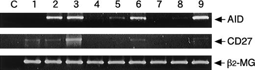 Fig. 4. Induction of AID from naive B cells. / Highly purified adult CD20+CD27+, CD20+CD27−, or CB B cells at the cell numbers of 0.5 × 106 cells were cultured with medium alone (lanes 1, 4, 7), 0.01% SAC, 50 U/mL IL-2, 50 ng/mL IL-10, and 1 μg/mL anti-CD40 cross-linked with CD32T for 1 day (lanes 2, 5, 8) or 4 days (lanes 3, 6, 9). After extraction of total RNA, RT-PCR was performed as described in “Materials and methods.” Each template contained the same of cDNA from RNA extracted from highly purified B cells. The C lanes represent control of contamination-free reaction, in which all PCR reagents are present, but there is no cDNA. The β2-microglobulin (β2-MG) was used as a positive control. Data are representative of the results of 3 experiments using different donors.