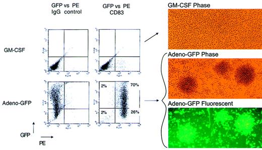 Fig. 3. Analysis of GFP expression in adenovirus-GFP–infected monocytes. / Monocytes were cultured overnight in SFM/G or infected with adenovirus-GFP at an MOI of 200. At 48 hours, cells were harvested, stained with either PE-labeled isotype-matched control antibodies or PE-labeled anti-CD83 mAb (x-axis), and subjected to multicolor FACS analysis to detect relative levels of expression of GFP (y-axis). In addition, phase contrast and fluorescent photomicrographs of both uninfected and infected cultures were taken to demonstrate GFP expression and virus-induced cell clustering.