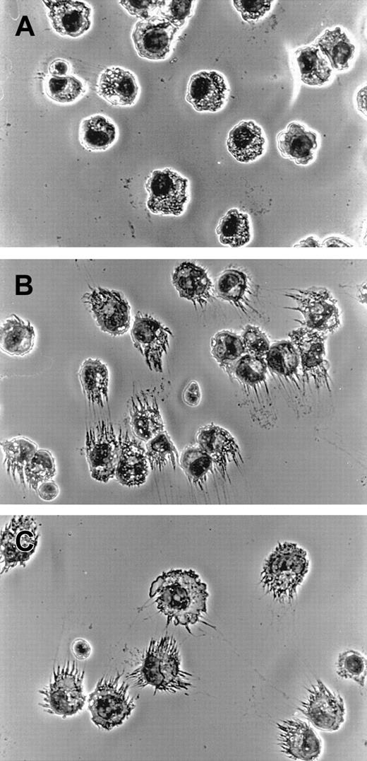 Fig. 4. DC morphology in adenovirus-infected monocytes. / Monocytes were cultured in SFM/G for 24 hours and then either infected with adenovirus-Luc at an MOI of 200 or treated with 50 ng/mL LPS. At 72 hours later, cells were harvested, and cytospin preparations were made onto glass slides, Wright stained, and subjected to photomicrography. Original magnification, × 400. Results are representative of 3 separate experiments with different donors. (A) Monocytes cultured in SFM/G. (B) Adenovirus-infected monocytes. (C) LPS-treated cells.