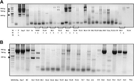 Fig. 1. Results after RT-PCR amplification with G.257/G.1225 primer pair screening all HLA-G isoforms. / Results are shown in (A) lesional and nonlesional skin and in (B) PBMCs of CL patients. Due to the low sensitivity of ethidium bromide staining, for some samples the bands are not visible. Using a melting curve analysis (data not shown) and the primer pair amplifying HLA-G1, it was possible to confirm that all the cases were transcribing HLA-G. The cDNAs from JEG-3 cell line and first trimester placenta (Pla) were used as positive controls. Instead of cDNA template, water (–) was run as a negative control; hs indicates healthy skin; l, lesional skin; n, nonlesional skin; BC, buffy coat preparation; and MWM, molecular weight marker.