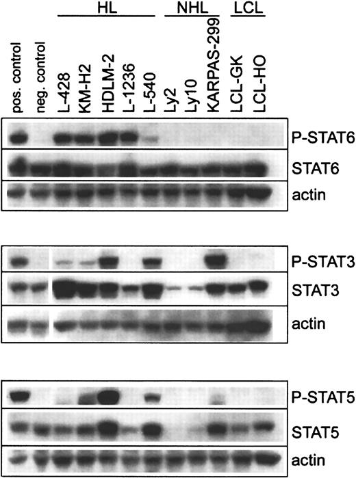 Fig. 1. Phosphorylation of STAT proteins in HL and NHL cell lines. / Cell lysates were prepared from HL-derived cell lines (L-428, KM-H2, HDLM-2, L-1236, L-540), B-cell NHL-derived cell lines (Ly2, Ly10), a T-cell NHL-derived cell line (KARPAS-299), and B-cell lymphoblastoid cell lines (LCL-GK, LCL-HO). Equal amounts of whole-cell lysates were subjected to SDS–polyacrylamide gel electrophoresis followed by Western blot analysis. Phosphorylated STAT proteins were detected using phosphospecific antibodies recognizing Tyr641-phosphorylated STAT6, Tyr705-phosphorylated STAT3, and Tyr694-phsophorylated STAT5. These experiments were repeated twice with similar results. For P-STAT6, Daudi cells stimulated for 15 minutes with 10 ng/mL IL-4 served as the positive control, and unstimulated Daudi cells served as the negative control. For P-STAT3, serum-starved HeLa cells stimulated with IFN-α served as the positive control, and unstimulated serum-starved HeLa cells served as the negative control. For P-STAT5, TF-1 cells stimulated for 15 minutes with 25 ng/mL GM-CSF served as the positive control, and unstimulated TF-1 cells served as the negative control.