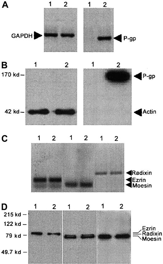 Fig. 1. P-gp expression by CEM-VBL100 cells. / (A) RT-PCR and (B) Western blot analyses for P-gp expression on CCRF-CEM (1) and CEM-VBL100 (2) cells. P-gp is expressed on the CEM-VBL100 cell line, derived from CEM cells by selection in medium containing 100 ng/mL VBL, and is undetectable in the parental CEM cell line at both the mRNA (A) and protein levels (B). (C) RT-PCR and (D) Western blot analysis for ERM expression on CCRF-CEM1 and CEM-VBL1002 cells. Both cell lines expressed comparable levels of ezrin, radixin, and moesin (C,D; arrows). GAPDH (A) and actin (B) levels in the relative lysates are shown.