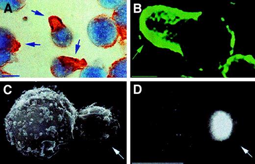 Fig. 2. Distribution of P-gp on CEM-VBL100 cells. / Control CEM-VBL100 cells presented uropoidal formations (arrow) on their surfaces (C, left panel). P-gp distribution on CEM-VBL100 cells appeared clearly polarized on these structures. The arrows point to the sites of P-gp polarization in immunocytochemistry (PAP, counterstaining with Mayer hemalum) (A), immunofluorescence (B), and immuno-SEM (C) analyses. Bar = 5 μm.