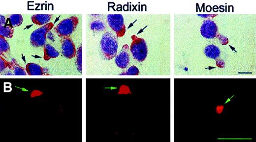 Fig. 3. Distribution of ERM proteins on CEM-VBL100 cells. / Immunocytochemistry (APAAP, counterstaining with Mayer hemalum) (A) and immunofluorescence (B) analyses in CEM-VBL100 cells for ezrin (left panels), radixin (central panels), and moesin (right panels). Note the extreme level of polarization of all the proteins on pseudopods or uropods of CEM-VBL100 cells, independent of the detection method used. Bar = 5 μm.