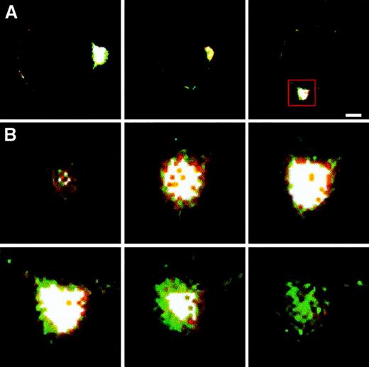Fig. 4. P-gp colocalization with ERM proteins. / (A) Double-staining immunofluorescence and LSCM analysis of P-gp colocalization with ezrin (left panel), radixin (central panel), and moesin (right panel). White color is the overlapping of green (P-gp) and red (ERM) signals. Bar = 1 μm. (B) A sequence of 6 optical sections obtained by the confocal analysis of a CEM-VBL100 cell stained for P-gp (green) and moesin (red) in the area of polarization squared in panel A (right panel). The most internal (upper left) to the most external (lower right) sections of the uropod double stained for moesin (red) and P-gp (green) are shown. The intermediate sections, corresponding to the juxta-membrane region, clearly showed a wide overlapping (white) of the moesin/P-gp staining.