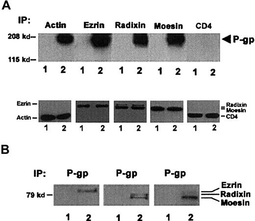 Fig. 5. P-gp association with ERM proteins. / (A) Upper panel: Western blotting for P-gp (arrow) in actin, ezrin, radixin, and moesin immunoprecipitates (IP) from the cytoskeletal/membrane fraction of CCRF-CEM (1) and CEM-VBL100 (2) cells. P-gp is clearly detectable in each ezrin, radixin, moesin, and actin immunoprecipitate only from CEM-VBL100 cells. Western blotting for P-gp in a CD4 immunoprecipitate from the cytoskeletal/membrane fraction of the same cell types (CD4) was included as a negative control for P-gp coimmunoprecipitation. Lower panel: Western blotting for actin, ezrin, radixin, moesin, and CD4 in actin, ezrin, radixin, moesin, and CD4 immunoprecipitates, respectively, from the cytoskeletal/membrane fraction of CCRF-CEM (1) and CEM-VBL100 (2) cells. To avoid overlapping with Ig heavy chains, actin and CD4 immunoprecipitates were separated by SDS-PAGE in nonreducing conditions (see “Materials and methods”), followed by blotting with the anti-actin or the anti CD4 mAb, respectively. The figure shows successful immunoprecipitation of each tested protein. (B) Western blotting for ezrin, radixin, and moesin in P-gp immunoprecipitates from the cytoskeletal/membrane fraction of CCRF-CEM (1) and CEM-VBL100 (2) cells. Each ERM protein is clearly detectable in P-gp immunoprecipitates only from CEM-VBL100 cell protein extracts.