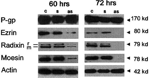 Fig. 6. Effects of antisense PONs on ERM expression. / Western blotting on membrane/cytoskeleton fraction of sense (s) or antisense (as) PON-treated or -untreated (c) CEM-VBL100 cells after a 60-hour (left panel) or a 72-hour (right panel) treatment. In both panels, 1 of 5 representative experiments is shown. Actin levels in the relative lysates are shown.