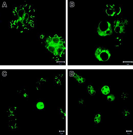 Fig. 2. Localization and staining patterns of mitochondria in PMNs. / PMNs were incubated as described in Figure 1. Then the cells were stained with 100 nM MitoTracker Green FM and analyzed with CLSM. (A) In fresh cells the mitochondria showed a distinct tubular shape. (B) In PMNs cultured without additions the mitochondria relocalized into large unstructured aggregates. (C) G-CSF prevented the mitochondrial aggregate formation. (D) zVAD-fmk did not influence mitochondrial aggregation. Bar is 5 μm. Results are representative of at least 3 independent experiments.