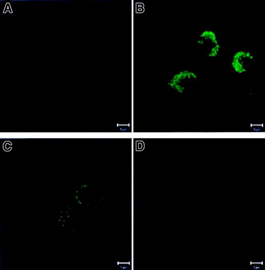 Fig. 4. Activation of caspase-3 in PMNs. / PMNs were cultured as described in Figure 1. Then the cells were fixed, permeabilized, stained with mAb specific for active caspase-3, and analyzed by CLSM. (A) Fresh PMNs showed faint background staining. (B) Overnight-cultured untreated PMNs revealed a bright punctate staining representing active caspase-3. (C) G-CSF strongly inhibited caspase-3 activation. (D) Cells treated with zVAD-fmk did not demonstrate active caspase-3. Bar is 5 μm. Results are representative of at least 3 independent experiments.