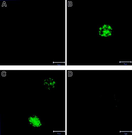 Fig. 9. Activation of caspase-3 in cytoplasts. / Cytoplasts were cultured as described in Figure 7. Then the cytoplasts were fixed, permeabilized, stained with mAb specific for active caspase-3, and analyzed by CLSM. (A) Fresh cytoplasts showed faint background staining. (B,C) Overnight-cultured untreated or G-CSF–treated cytoplasts, respectively, revealed bright punctate staining representing active caspase-3. (D) Cells treated with zVAD-fmk did not demonstrate active caspase-3. Bar is 5 μm. Results are representative of at least 3 independent experiments.