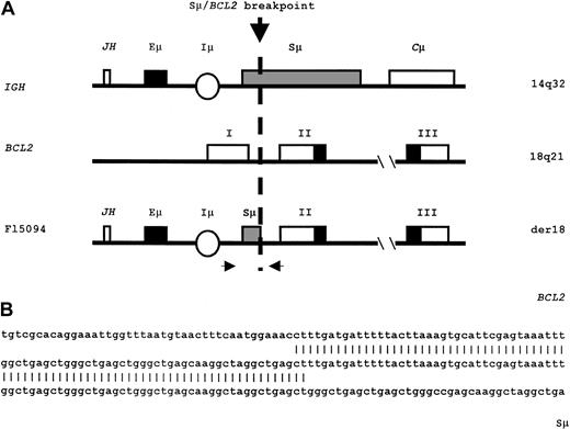 Fig. 1. Genomic organization of the. / IGH-BCL2 breakpoint. (A) Schematic demonstration of part of the germline IGH locus (IGH), the germline 5′ part of the BCL2 gene (BCL2), and the fusion product, der(18), observed in FL5094 (Fl5094). The 2 arrows indicate the position of primers used for PCR and genomic sequence analysis. (B) The sequence of the breakpoint junction and alignment with BCL2 intron 1 and germline Sμ sequences. The sequence shown is part of a 500–base pair (bp) product obtained with primers 5′-GGCAATGAGATGGCTTTAGCTG (5′Sμ forward, bp 66 through 87 Genbank X54713) and 5′-CATACACACACTACAAGTAACACGG (BCL2intron 1 reverse, bp 1072 through 1094, Genbank M13994.1). Nucleotides 1 through 38 are homologous to bases 442 through 485 of human Sμ sequence (X54713), and nucleotides 41 through 72 are homologous to bases 1001 through 1039 of BCL2 sequence (M13994.1) The genomic chromosomal breakpoint is located at nucleotides 41 through 42 (ct), which are common to both sequences.