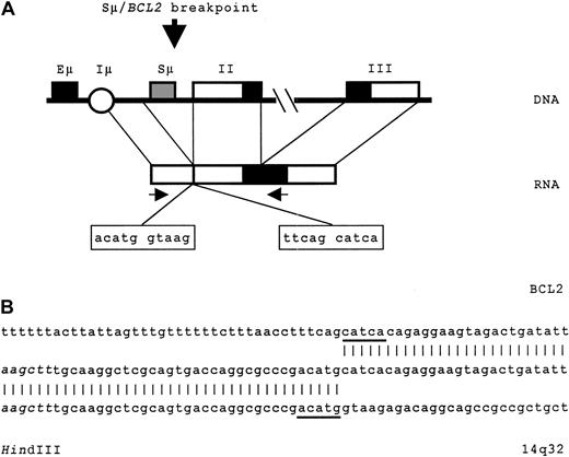 Fig. 2. An IGH-BCL2 hybrid transcript resulting from the t(14;18) translocation results in. / (A) The top diagram shows the organization of der(18) transcript as result of the t(14;18) translocation. The transcription initiates from Iμ and splices to an acceptor site at exon 2 ofBCL2. There is also splicing from exon 2 to exon 3. Donor and acceptor sites between Iμ and BCL2 exon 2 boundary are shown within the boxes. The orientation of primers used for RT-PCR is shown with arrows. (B) The complementary DNA (cDNA) sequence of the breakpoint junction and alignment with germline 14q32 sequence preceeding Sμ and BCL2 cDNA sequences are shown. The sequence is part of a 1-kb product obtained with primers 5′-AGCCCTTGTTAATGGACTTGGAGG (5′Iμ forward, Genbank X97051, bp 91629 through 91652) and 5′-CAGATAGGCACCCAGGGTGAT (BCL2 exon 3, reverse Genbank M13994.1, bp 2146 through 2167). The relative location of these primers is represented by arrows in panel A. Nucleotides 1 through 78 are homologous to bases 91629-91706 of 14q32 sequence (X97051) located 5′ of Sμ in germline DNA. Nucleotides 78 through 166 are homologous to bases 1172 through 1260 of BCL2 sequence (M13944.1). The breakpoint on 14q32 is located 30 bp beyond a known HindIII site (shown) preceding the Sμ sequence. The remaining parts of the splice donor and acceptor sites are underlined.