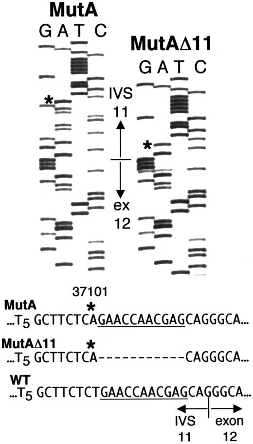 Fig. 3. PBL from Sib B possess 2 different ADA mutations. / Sequences from 2 clones of ADA fragment g.31016-31920 amplified from PBL DNA of Sib B. The sequence shown spans g.31684 in IVS 11 to g.31738 in exon 12. The normal IVS 11/exon 12 junction is indicated. Asterisks indicate the “A” at g.31701 (MutA) in both clones, instead of the wild type “T.” The clone labeled MutAΔ11 also has an 11-nt deletion of g.31702-31712 (dashes). For reference, the deleted segment is underlined in the wild-type and MutA sequences.