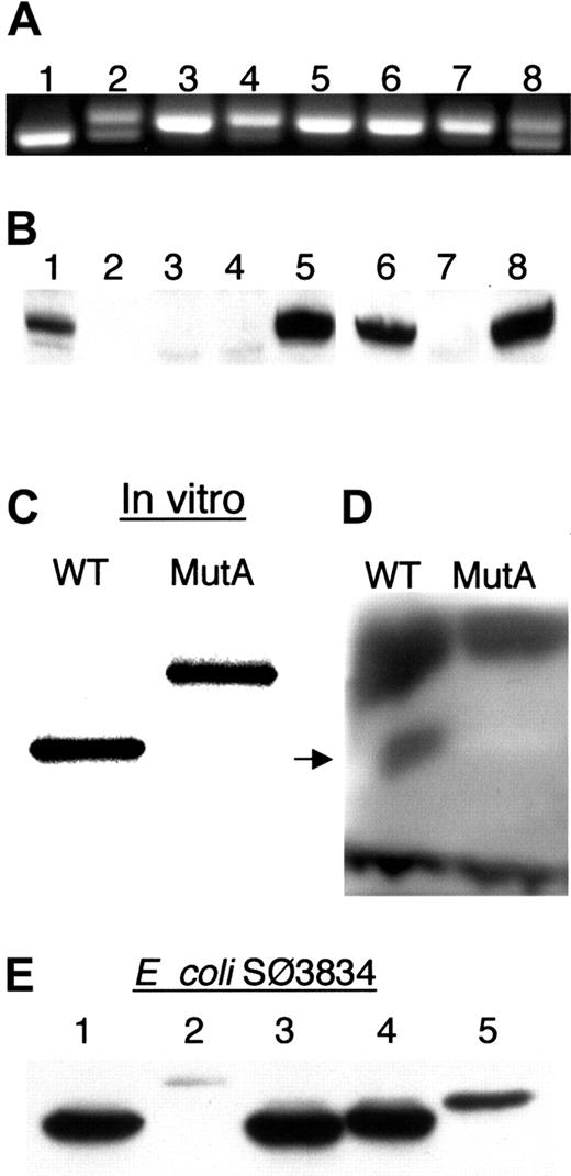 Fig. 4. Expression of ADA mRNA and ADA proteins. / (A) Ethidium bromide–stained agarose gel of fragment c.1099-1290 amplified from uncloned ADA cDNA. A 191-bp product is expected from both MutAΔ11 and wild-type ADA cDNA; MutA-derived cDNA gives a 204-bp product. Control lanes: 1, wild-type ADA cDNA; 8, equal mixture of wild-type and MutA ADA cDNAs. Sib B (lanes 2-4): 2, B LCL; 3, posttreatment T LCL; 4, pretreatment T cells. Sib A (lanes 5-7): 5, B LCL; 6, T LCL; 7, T cells. (B) Western blot of ADA in extracts of lymphoid cells. Lanes 1-5, T cells and T LCLs: 1, Sib B pretreatment T cells; 2, Sib A pretreatment T cells; 3, Sib B posttreatment T LCL; 4, Sib A posttreatment T LCL; 5 control T LCL. Lanes 6-8, B LCLs: 6, Sib B; 7, Sib A; 8, control. (C-E) Expression of recombinant MutA-derived ADA protein. (C) SDS-PAGE of 35S in vitro translation products resulting from the wild-type (WT) and MutA cDNA. (D) In situ assay for ADA activity of the translation products shown in panel C after nondenaturing electrophoresis. Arrow indicates position of human ADA. Dark bands at the top and bottom are, respectively, rabbit ADA and rabbit hemoglobin. (E) Western blot of ADA proteins expressed in E coli SØ3834. Lanes: 1, wild type; 2, MutA; 3, G360X; 4, 360-363EPTS; 5, 360-363EPTS+20 (see “Materials and methods” for description).