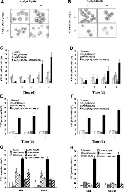 Fig. 1. Evidence for cooperation between As2O3 and cAMP signaling pathways. / Morphologic features of NB4 (A) and NB4-R1 (B) cells after a 96-hour exposure to the drugs indicated. Original magnification × 1000. Expression of CD11b integrin and NBT-reducing activity of NB4 (C,E) and NB4-R1 cells (D,F) following the indicated treatments. Inhibitory effect of H89 on CD11b expression (G) and NBT activity (H) in NB4 and NB4-R1 cells treated by the indicated drugs for 5 and 4 days, respectively, is shown. Each value represented the mean ± SD of 3 independent measurements.