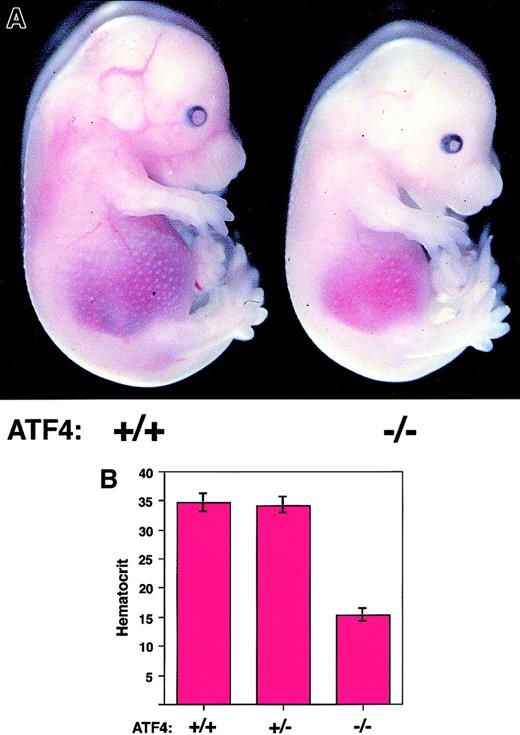 Fig. 2. ATF4−/− embryos are anemic. / (A) Gross appearance of 15.5-dpc embryos. The ATF4−/−embryo (right) is paler and smaller than a wild-type littermate (left). The pupils of ATF4−/− embryos are smaller. The gross appearance is otherwise normal. (B) Hematocrit values for ATF4+/+ (n = 35), ATF4+/− (n = 51), and ATF4−/− (n = 29) 15.5-dpc embryos. Error bars represent SEM. The mean hematocrit values for ATF4−/− 15.5-dpc embryos were significantly lower (P < .0001) than those for either ATF4+/+ or ATF4+/−embryos.