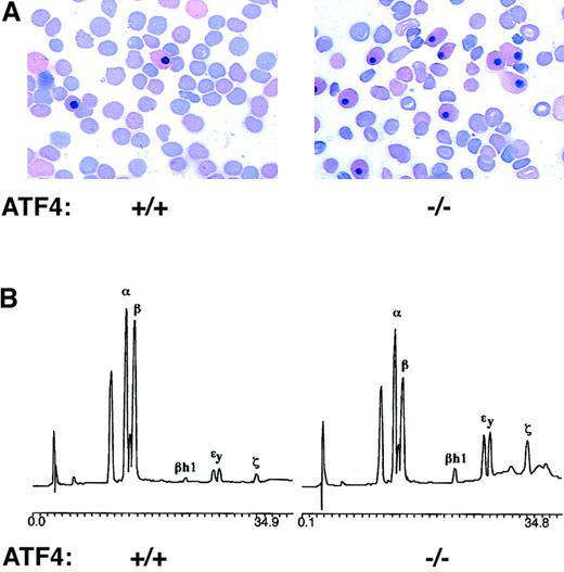 Fig. 3. Primitive erythrocytes persist in the circulation of 15.5-dpc ATF4−/− embryos. / (A) Blood smears from 15.5-dpc embryos stained with Wright-Giemsa stain. The blood smear from a ATF4−/− embryo (right) shows a greater than 2-fold increase in the percentage of nucleated erythrocytes compared with the sample from its wild-type littermate (left). Magnification 1000 ×. (B) HPLC analysis of globin chains. Blood from the 15.5-dpc ATF4−/−embryo (right) had an increased level of embryonic globin chains (βh1, εy, and ζ) compared with blood from its wild-type littermate (left). The percentages of α globin chains that were embryonic (ζ) were 10.7% ± 1.6% in the ATF4−/− embryo and 3.9% ± 0.8% and 5.1% ± 0.6%, respectively, in the wild-type and heterozygous embryos. The percentages of β globin chains that were embryonic (βh1 and εy) were 32.3% ± 3.7% in the ATF4−/−embryo and 14.9% ± 2.9% and 12.0% ± 1.7%, respectively, in the wild-type and heterozygous embryos.