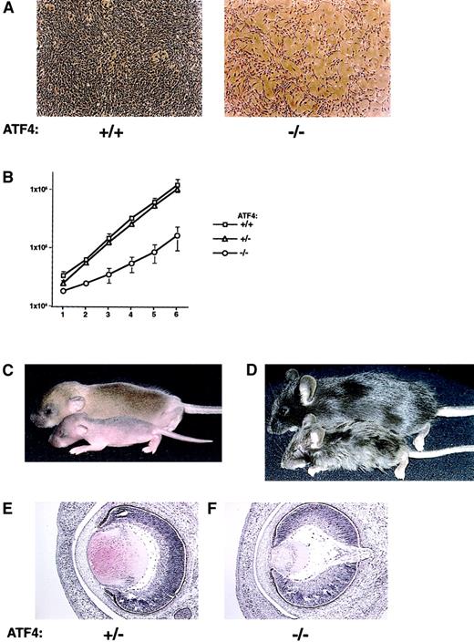 Fig. 6. Loss of ATF4 activity affects primary MEF proliferation, postnatal growth, and embryonic lens formation. / (A) In vitro proliferation defect in primary MEFs from ATF4−/− embryos. Passage-2 MEFs derived from 15.5-dpc embryos were plated at a density of 2 × 104 cells/60-mm plate. Representative regions at 5 days of culture of cells from wild-type (left) and ATF4−/− (right) embryos are shown. Magnification 40 ×. (B) Quantitation of the MEF growth rate from 15.5-dpc embryos. Fibroblasts were derived from ATF4+/+(n = 3), ATF4+/− (n = 7), and ATF4−/−(n = 5) 15.5-dpc embryos. Error bars represent SEM. (C) Seven-day-old ATF4+/+ and ATF4−/− mice. The ATF4−/− mouse (bottom) is smaller and shows a delay in hair growth compared with its wild-type littermate (top). (D) ATF4+/− and ATF4−/− littermates 4 weeks after birth. The ATF4−/− mouse (bottom) is runted and has severe microphthalmia. The heterozygote (top) is normal in appearance. (E) Histologic study of lens from 16-dpc embryos. The lens from the ATF4−/− embryo is considerably smaller and consists of primary lens fiber cells with no apparent formation of secondary lens fiber cells. Magnification 100 ×.