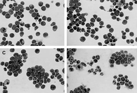 Fig. 4. Morphology of the different cytokine-dependent EML cells. / Cytospin preparations of the indicated cells stained with Wright-Giemsa. Cells include (A) SCF-dependent EML cells, (B) EML cells treated overnight with IL-3, (C) EML/GM-CSF cells, and (D) EML/GM-CSF cells treated for 5 days with ATRA (10−6 M). Magnification is × 400.