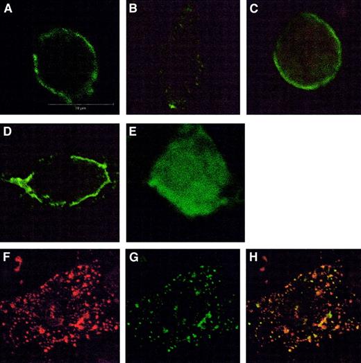 Fig. 2. Immunofluorescence detection of CCR5 using confocal microscopy. / (A-D) Effects of inhibitors on CCR5 internalization in CHO.CCR5 cells. (A) Untreated cells, stained with anti-CCR5 antibody. (B) Cells treated with MIP-1α. (C) Cells pretreated with sucrose. (D) Cells pretreated with nystatin; cells were grown on coverslips for 24 hours and then treated with inhibitors and chemokine as described in “Materials and methods.” Similar results were obtained for filipin or in CHO.CCR5.CD4 cells (data not shown). (E-H) Effects of CCR5 activation on arrestin-2 movement in CHO.CCR5 cells. (E) Untreated cells transfected with pEGFP–arrestin-2. (F-H) Cells treated with MIP-1α as described and then stained with anti-CCR5 antibody and rhodamine-conjugated secondary antibody. (F) CCR5 (red). (G) pEGFP–arrestin-2 (green). (H) Overlay arrestin-2 and CCR5.