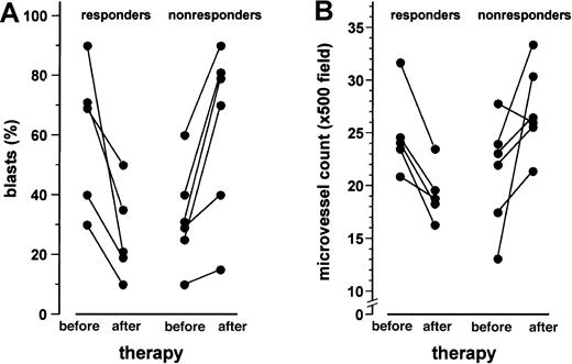 Fig. 2. Leukemic blast cell infiltration and microvessel density of the bone marrow before and after 1 month of treatment with thalidomide. / Data are presented as individual values. A significant reduction of the blast cell infiltration in the 5 patients responding to thalidomide (panel A) with a concomitant decrease of the microvessel counts (panel B) was observed (P < .05, Wilcoxon matched-pair signed rank test). In contrast, in the 6 nonresponding patients, the percentage of blast cell infiltration (panel A) and microvessel density (panel B) increased (P < .05).