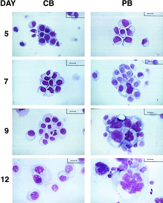Fig. 1. Morphologic differences between CB- and PB-derived megakaryocytic cells. / Morphology of MKs derived from CB- (left panels) and PB-CD34+ cells (right panels) induced to differentiate in serum-free medium in the presence of TPO (100 ng/mL) is presented. Cytospins were observed at different days by light microscopy after May-Grünwald staining. (Bar = 10 μm.)