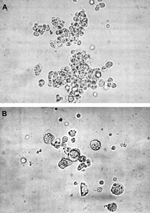 Fig. 5. Morphologic aspects of CB and PB megakaryocytic colonies. / CD34+ cells purified from CB or PB were assessed for their capacity to give rise to MK colonies when cultured in 0.9% methylcellulose using the same serum-free medium of the liquid suspension culture containing 50 ng/mL TPO. (A) CB-derived multifocal BFU-MK colony after 16 days of culture, showing > 100 small cells. (B) PB-derived CFU-MK colony at day 12 of culture, with few large cells. Colonies were evaluated by inverted light microscopy. (Original magnification, × 32.)