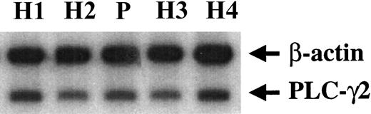 Fig. 3. Platelet PLC-γ2 mRNA levels in the patient and healthy subjects. / Platelet RNA from the patient (P) and healthy subjects (H) was subjected to RT-PCR in the presence of 32P-dCTPs using primers for PLC-γ2 corresponding to 3208 nt to 3229 nt (forward) and 3621 nt to 3642 nt (reverse), and for β-actin as described in “Patient, materials, and methods.” The products were subjected to gel electrophoresis, transferred to membrane, and analyzed by phosphorimaging. Figure is representative of 2 separate experiments.